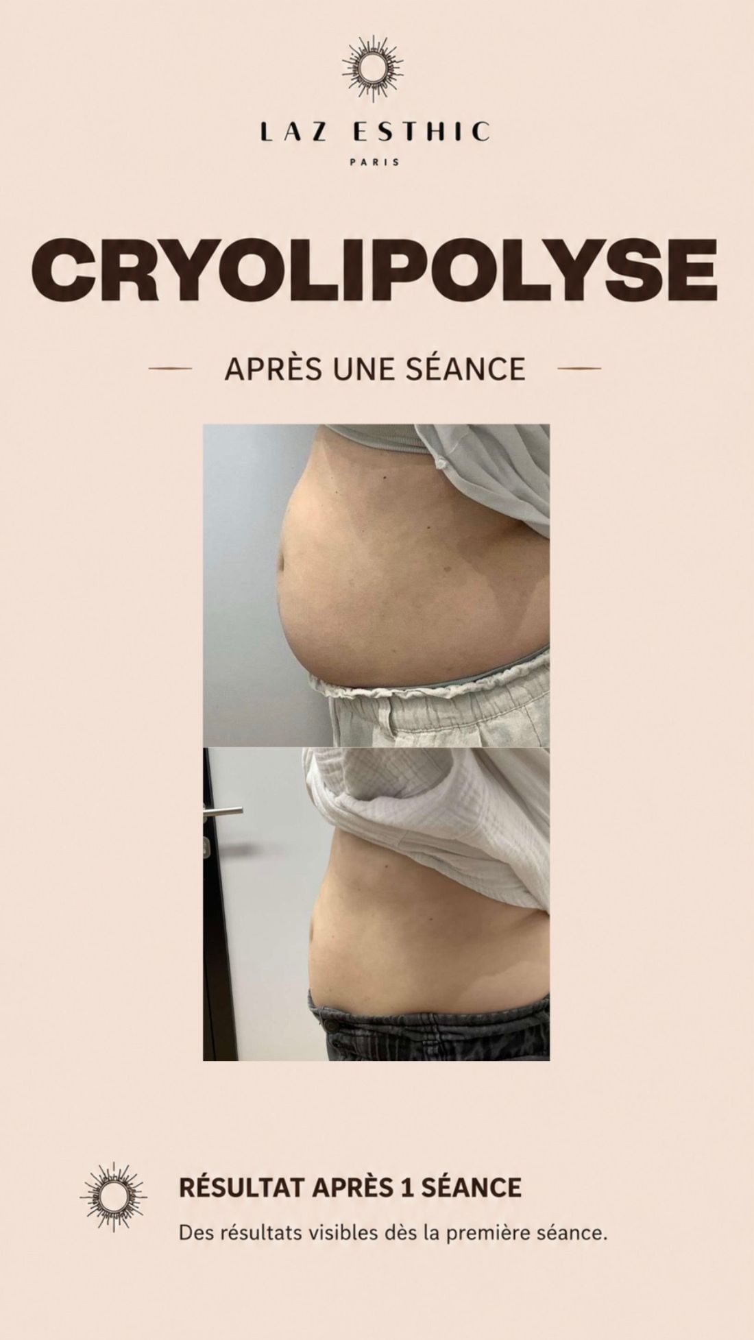 Avant / Après