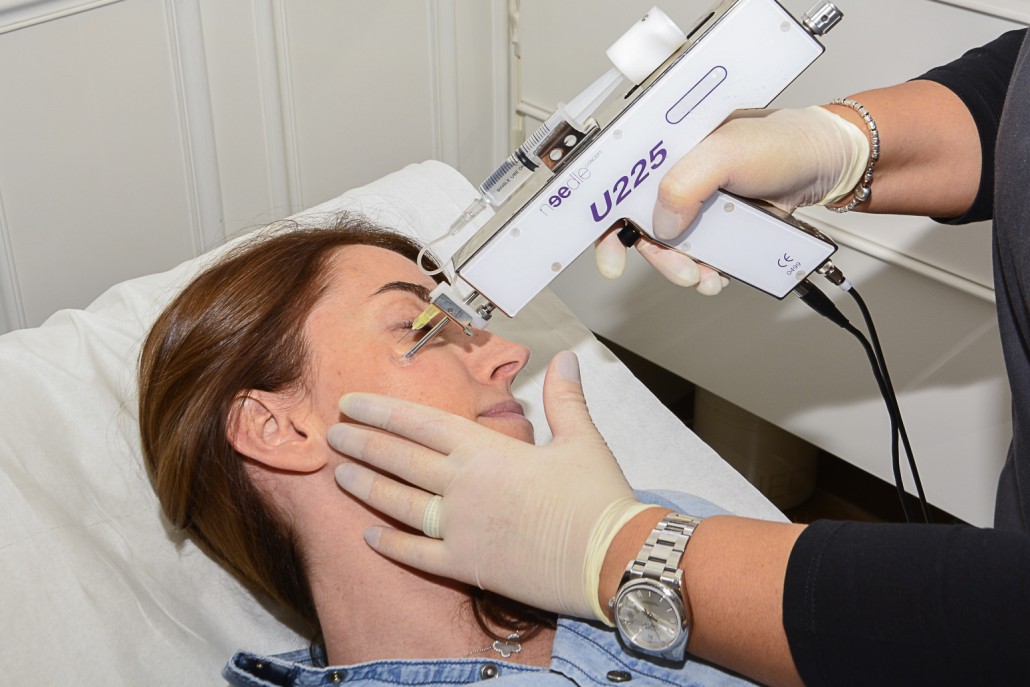 Mesotherapie Laz Esthic